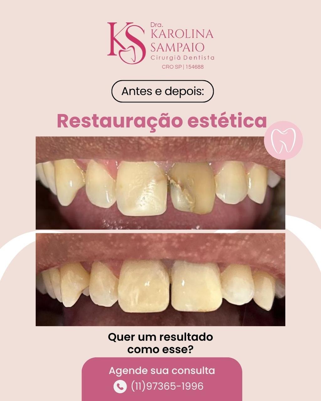 Resultado 11